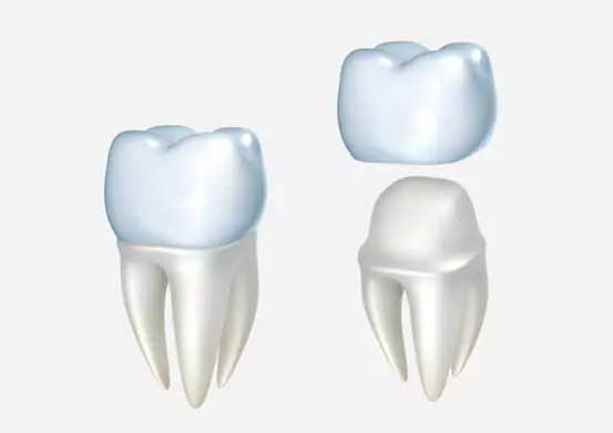 Dental Crowns