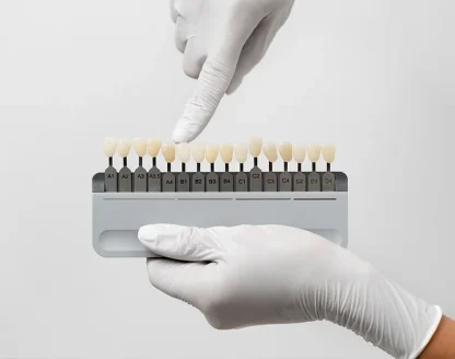 What Every Roseville Patient Needs to Know About Wearing Temporary Veneers 